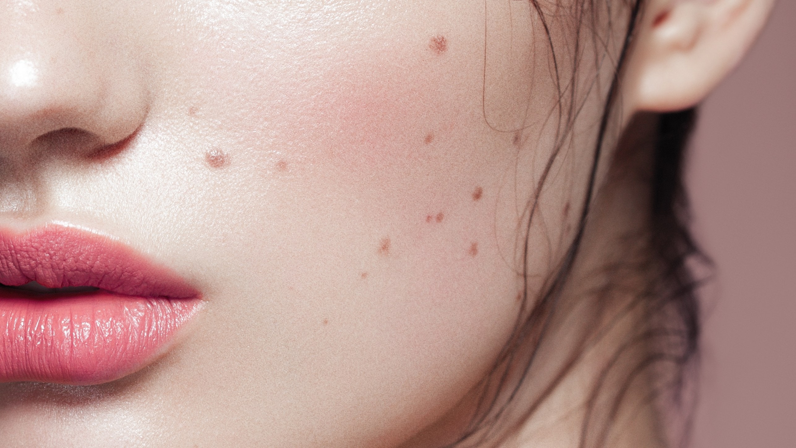 How to Safely Remove Moles With Makeup